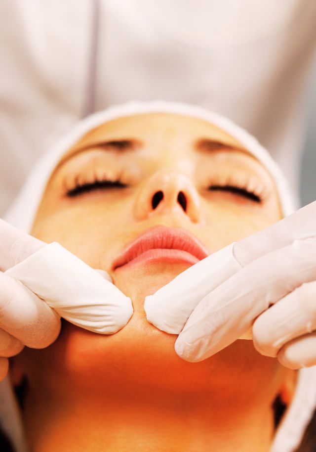 Chemical Peels