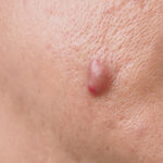 Dermatologist in Islamabad