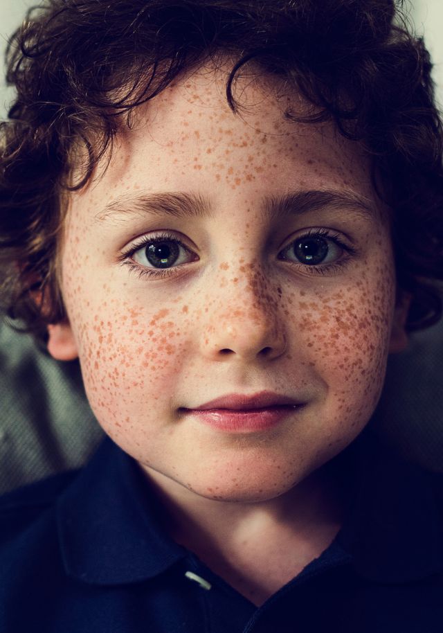 Psoriasis & Chronic Skin Conditions