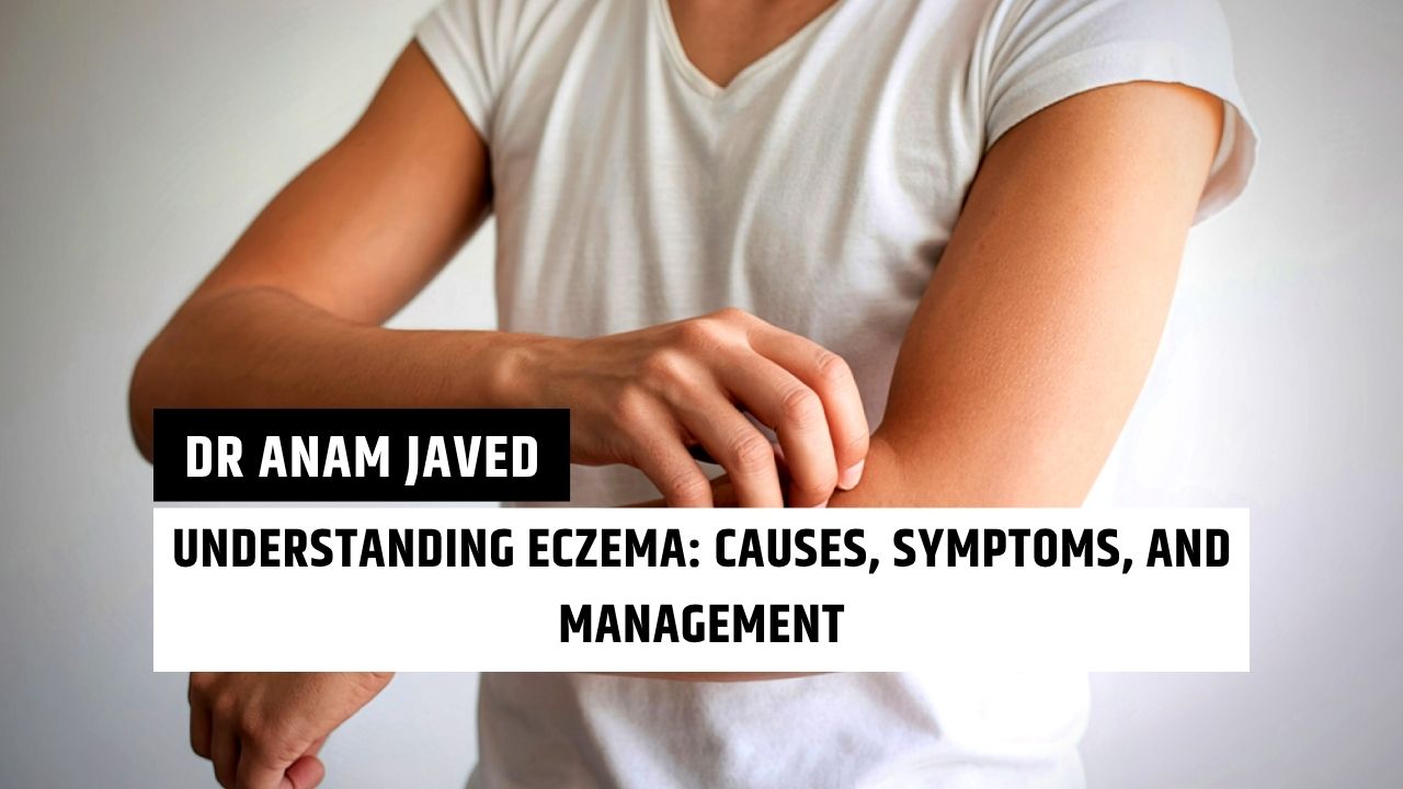 Atopic Dermatitis