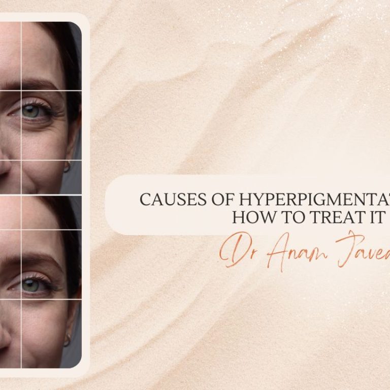 causes of hyperpigmentation and how to treat it